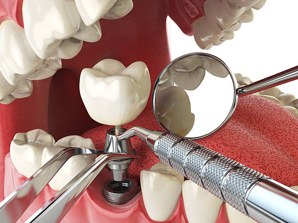 Best Emergency Treatment for Jaw Pain or Injury in Lake Alfred, FL